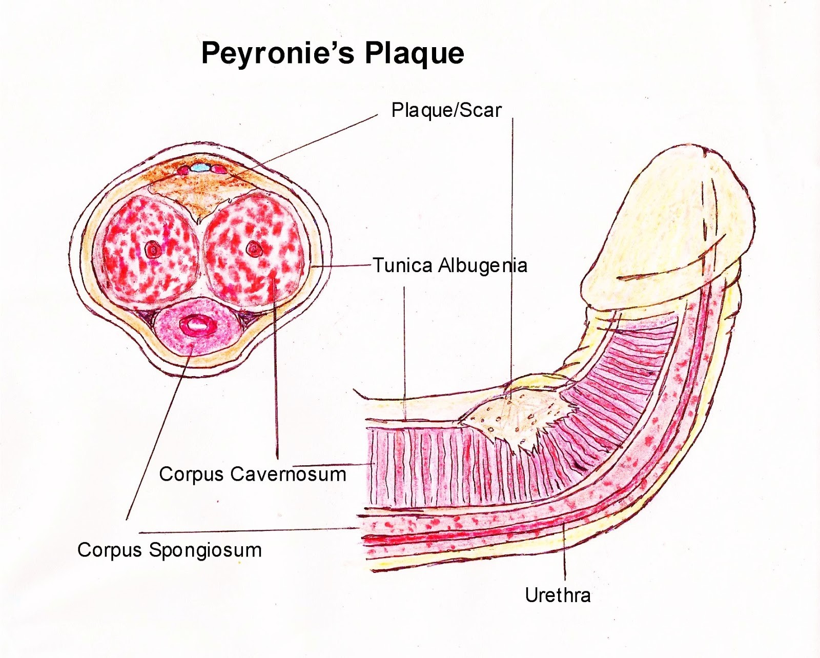 curved penis